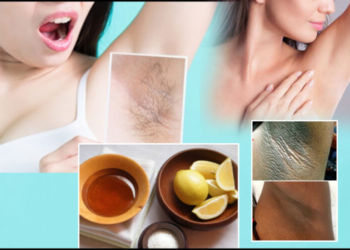 5 Natural Ways To Get Rid Of Dark armpits