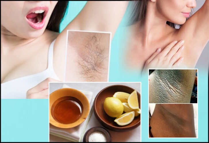 5 Natural Ways To Get Rid Of Dark armpits