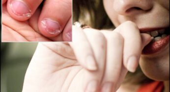 Biting Your Nails : గోళ్లు కొరికే అలవాటు ఉందా? ఈ జబ్బుల ముప్పు ఎక్కువ