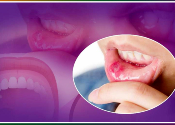 how to cure mouth ulcers fast naturally