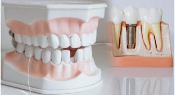 Teeth Whitening Tips : దంతాలు తెల్లగా మిళమిళ మెరిసిపోవాలంటే.. ఈ టిప్స్ ఫాలో అవండి..