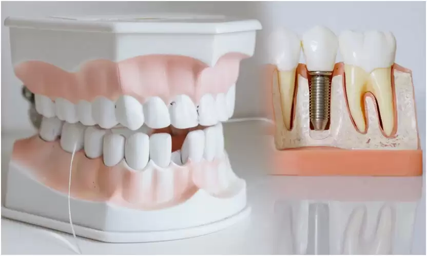 teeth problems and solutions in telugu