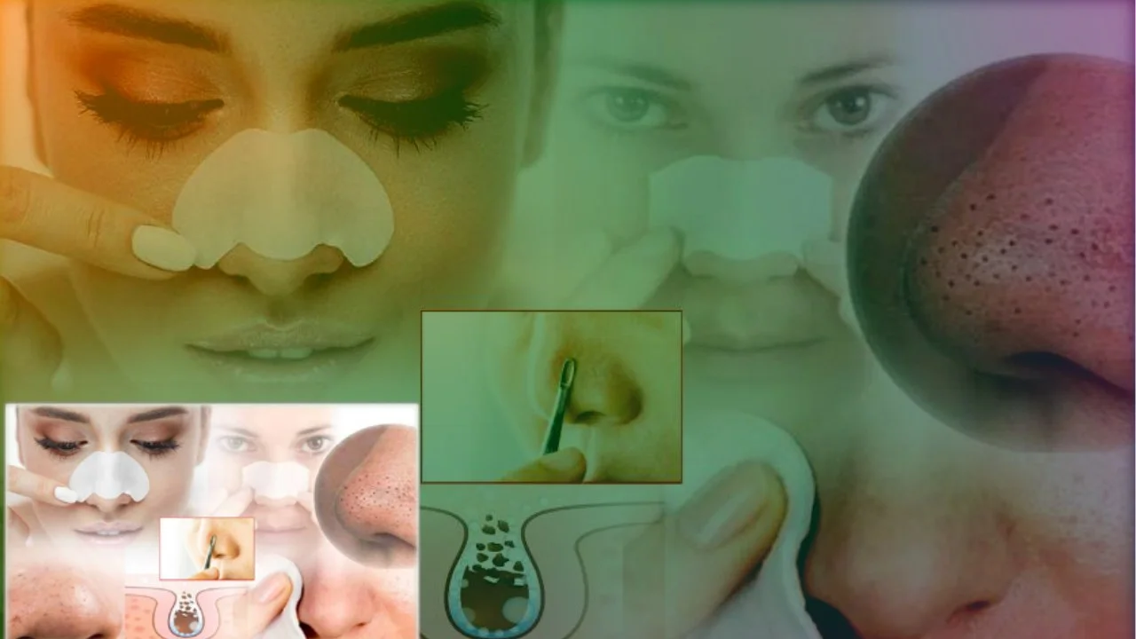 how to get rid of blackheads overnight