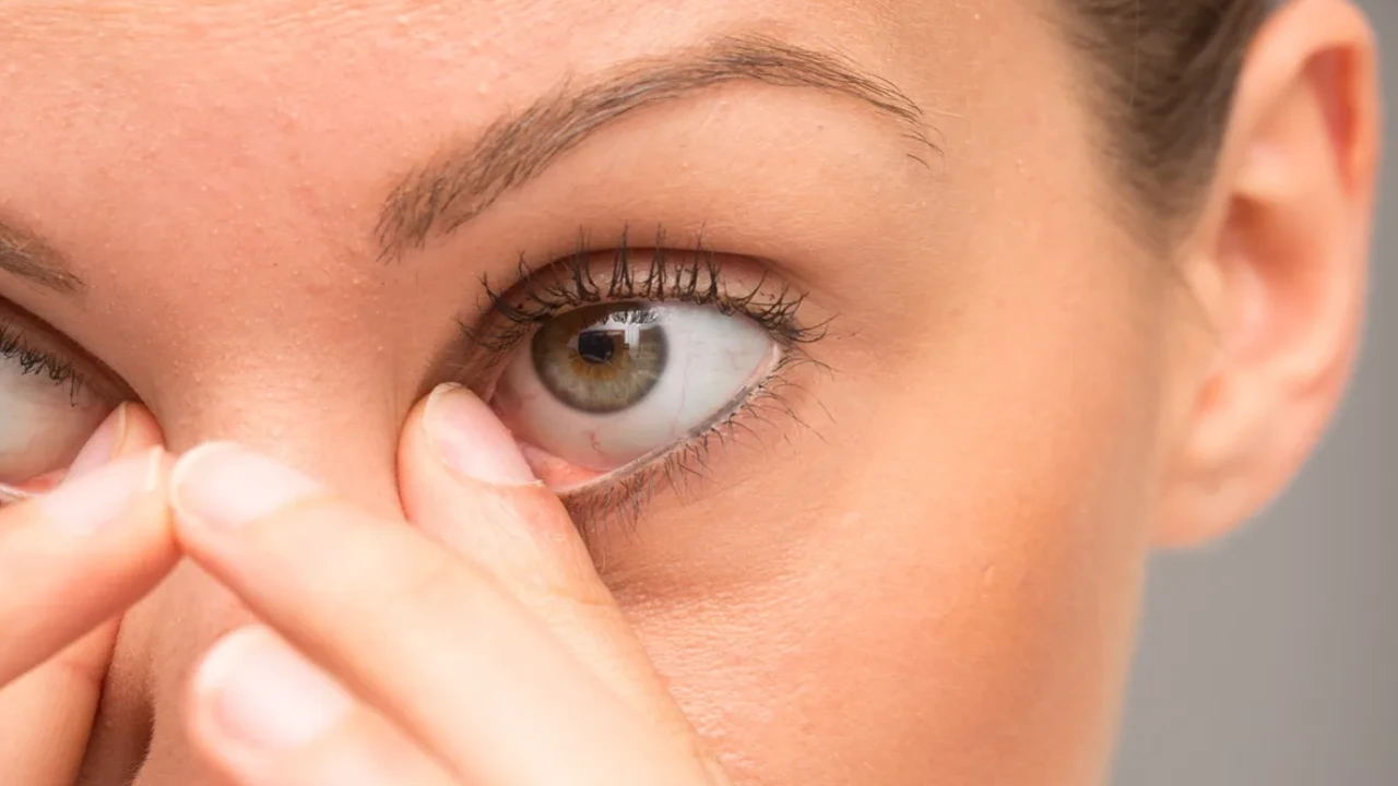 Eye cataract can be cured with ravi chettu leaves in telugu
