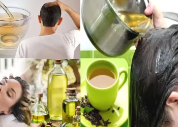 Hair Loss Tips : what oil is best to stop hair fall in telugu