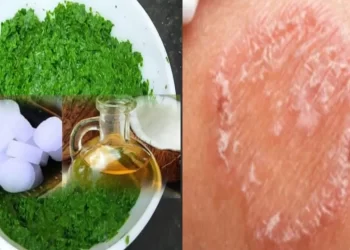 ringworm home remedy for humans in telugu