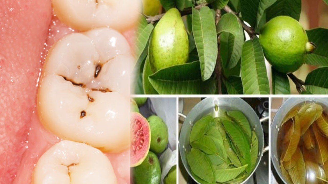 Dental Problems : best home remedy for tooth worms in telugu