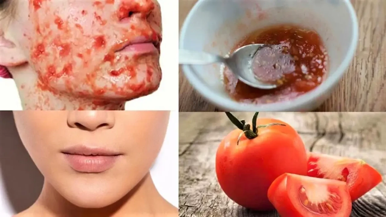 Tomato Beauty Tips : How to get glowing skin with tomato in telugu